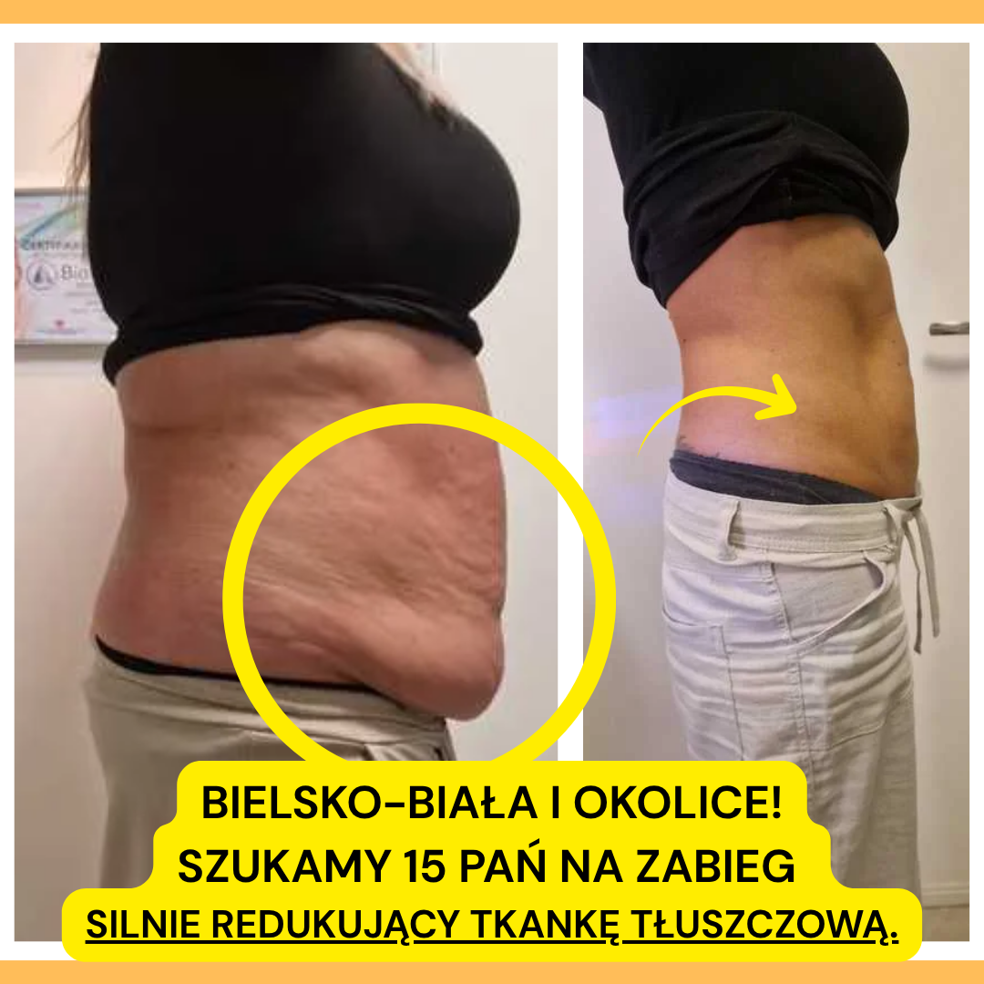 Kriolipoliza – ilustracja gabinetu